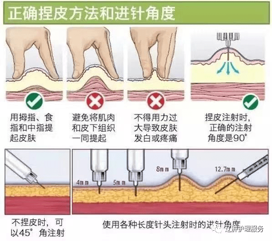 低分子肝素钙注射部位图片