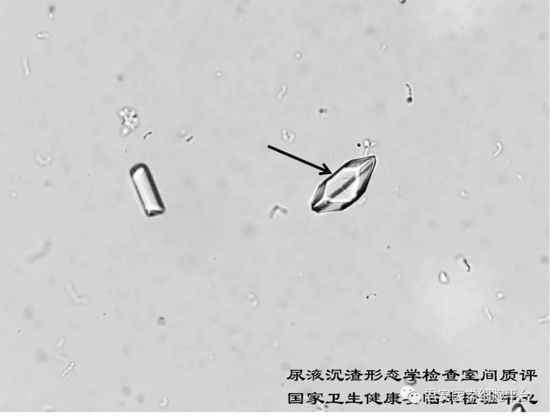 點擊空白處查看答案磷酸銨鎂結晶(三聯磷酸鹽)往期回顧【君安風采】