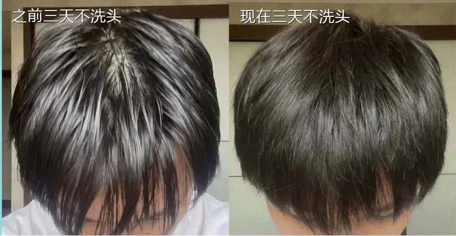 洗头|脱发、秃头，又丑又显老！这样做，头发浓密，更显年轻好气质