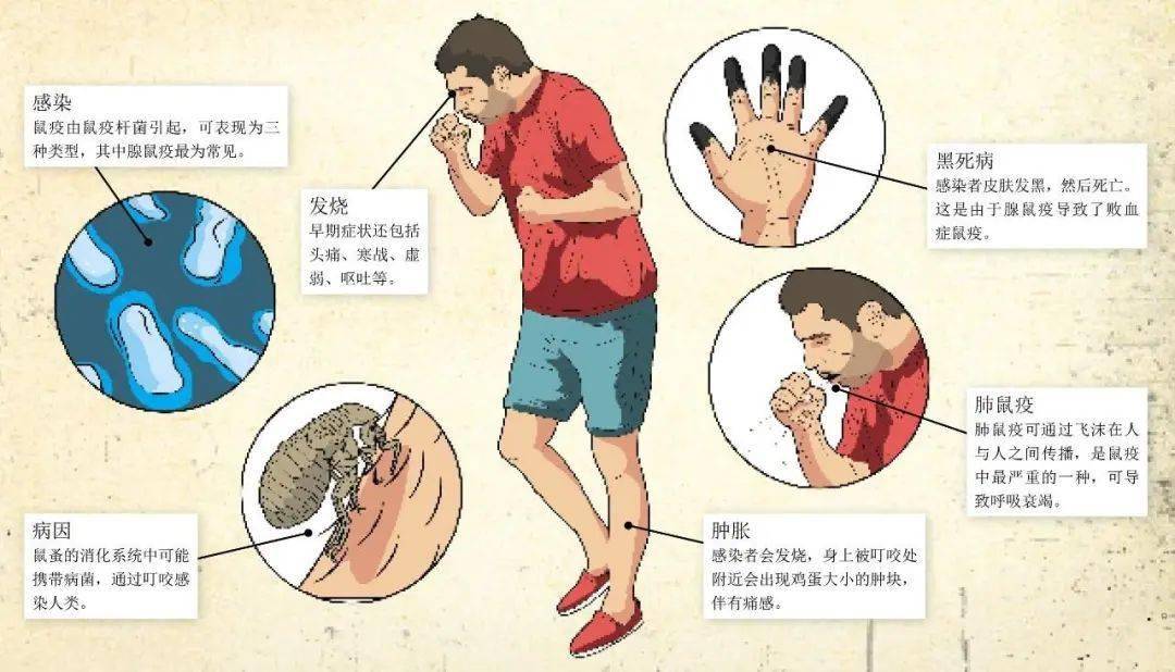 宁夏银川报告1例输入性鼠疫病例!人是怎么感染鼠疫的?