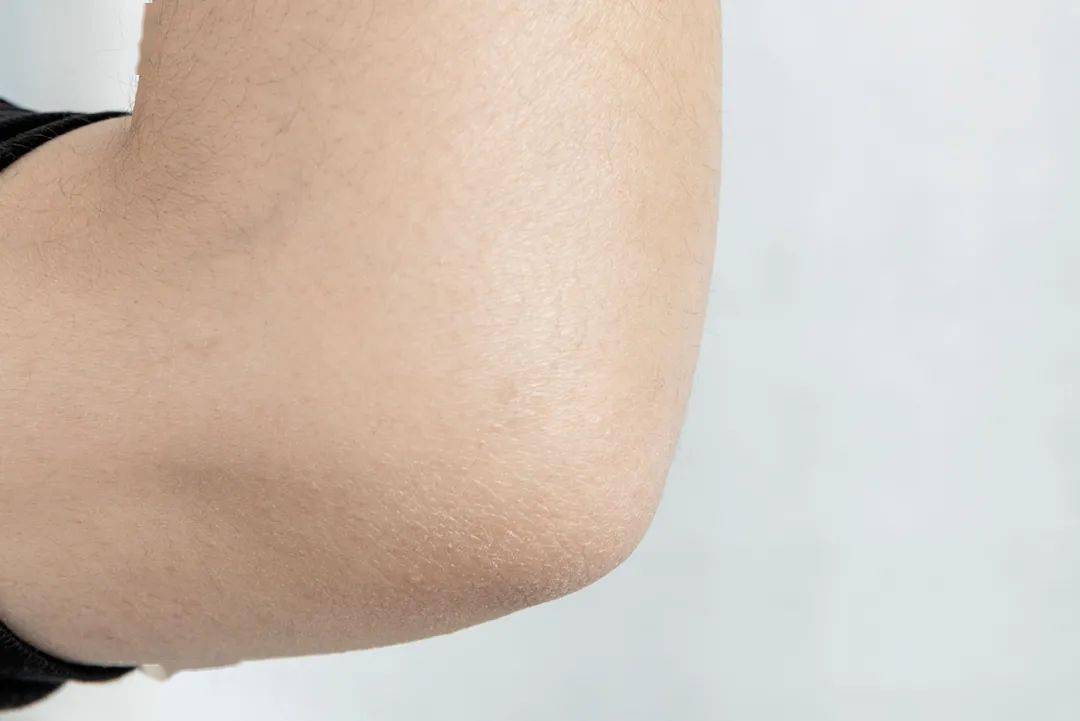 皮肤|观方好物 | 华山医院研制的这罐身体乳，我能囤一辈子