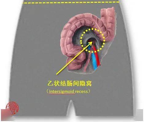 直肠隐窝的位置示意图图片