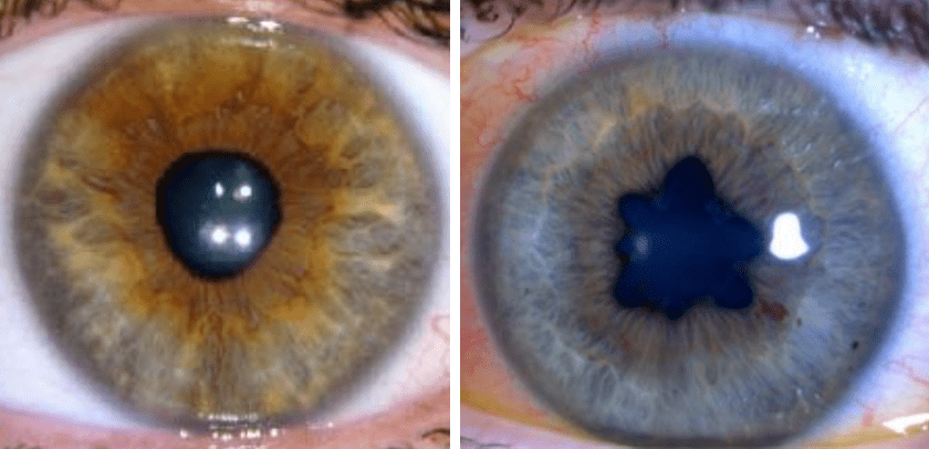 定睛一看果然是gan生成的华人团队利用瞳孔形状判断真假人像