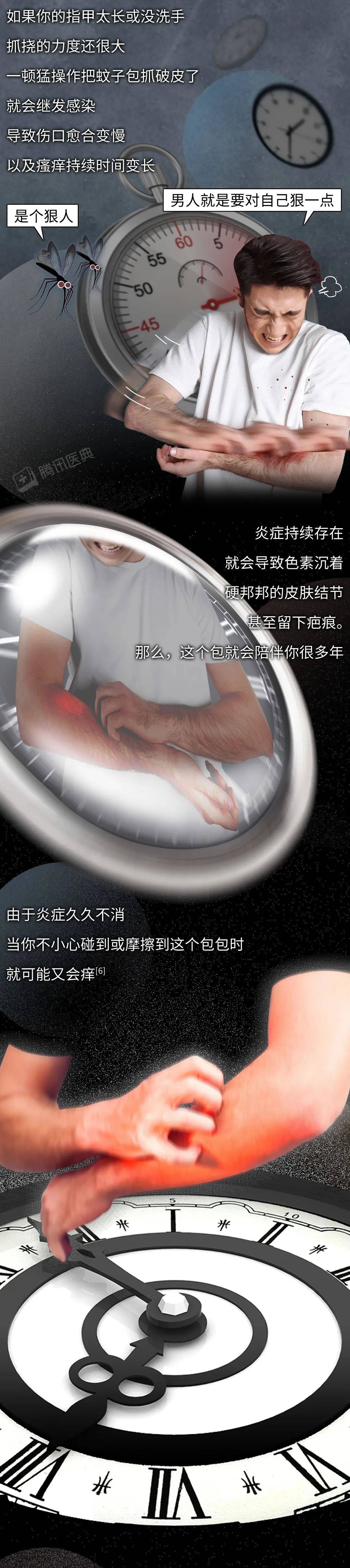 评论|被蚊子咬了，再痒也别挠，教你3招马上止痒