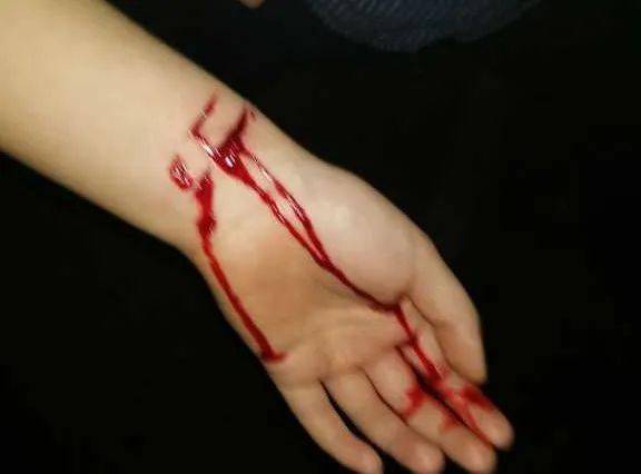 男生割手腕流血图片图片
