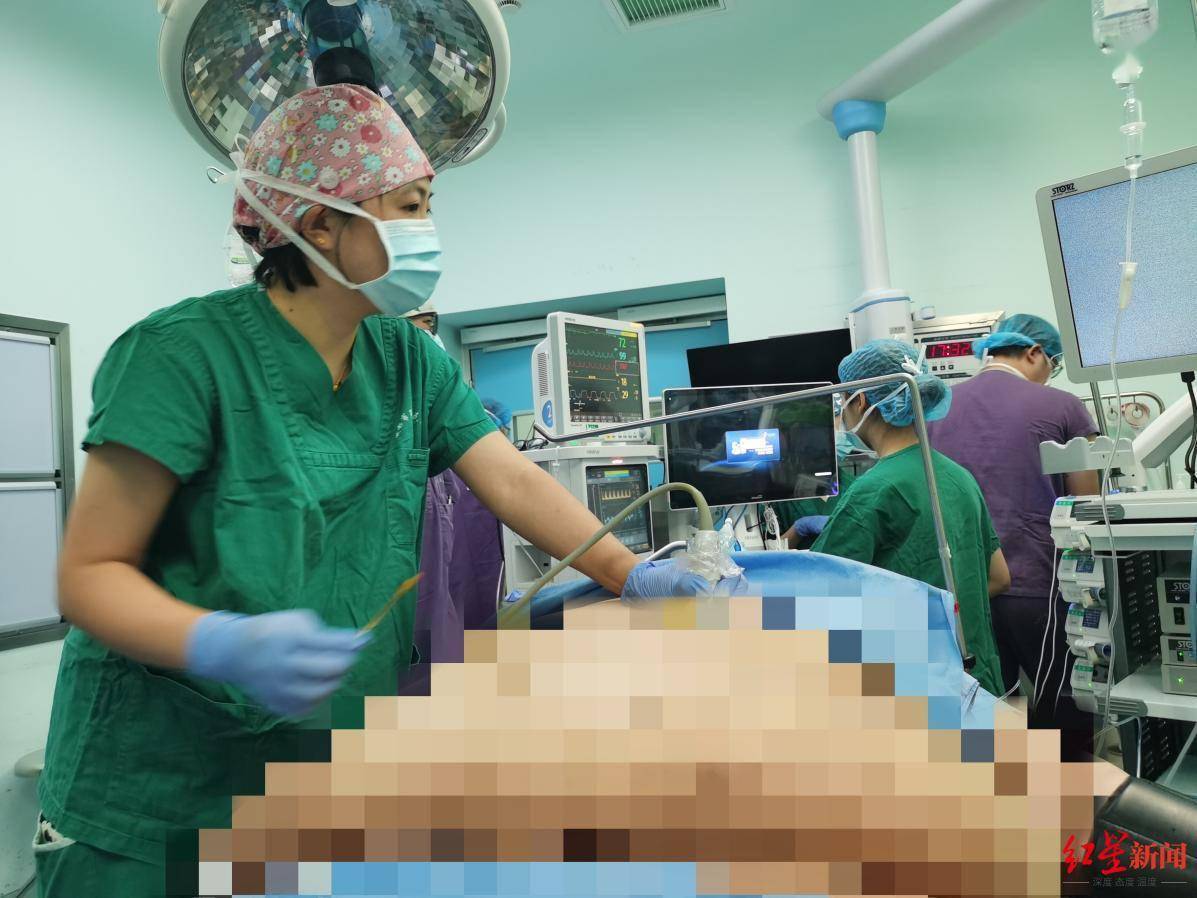 进行了|526斤超级肥胖小伙手术减重，“再胖下去，人就没了”
