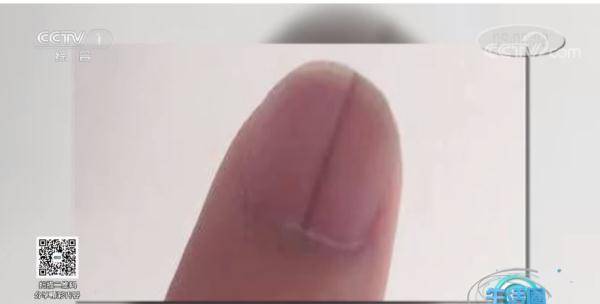 变化|请低头：长这几种指甲的人注意了