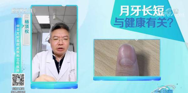 变化|请低头：长这几种指甲的人注意了