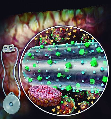 设备|人造“胰腺”来了！