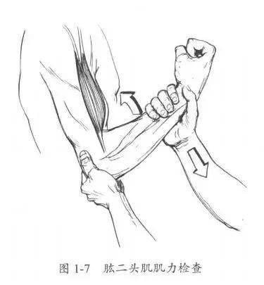 上肢神经根损伤评估c5t1神经根检查