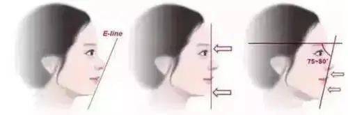 奖励|生娃奖励上亿，黑道千金依旧逃不掉当生育机器的命运？