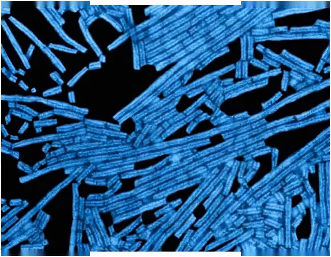 烟草花叶病毒蛋白亚基图片