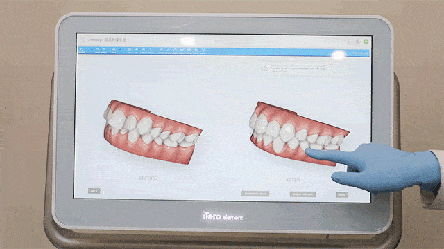 show|今晚19:00！锁定康贝佳口腔直播show，限时秒杀钜惠，不见不散！