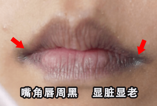 急救|唇纹又深又显老！急救起皮干裂，嘴巴像融化了一样，又软又糯贼滑溜！