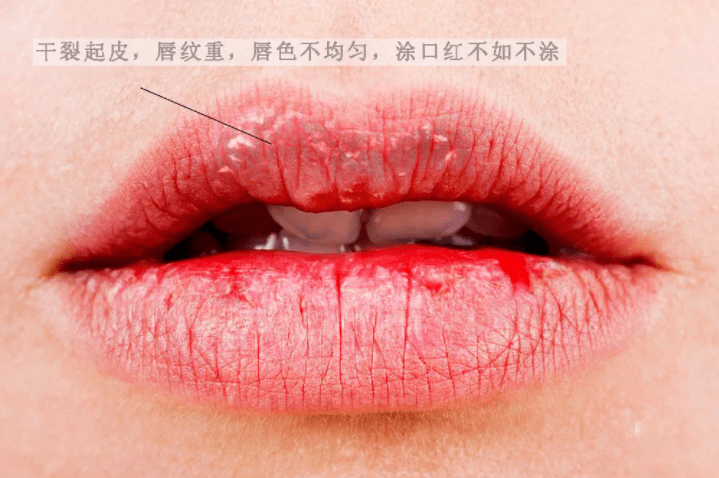 急救|唇纹又深又显老！急救起皮干裂，嘴巴像融化了一样，又软又糯贼滑溜！
