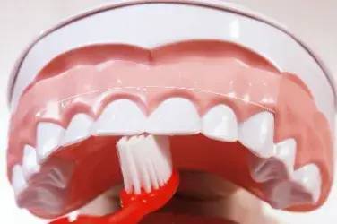 图片|5岁男孩突发急性肾炎，病根竟然是在口腔里