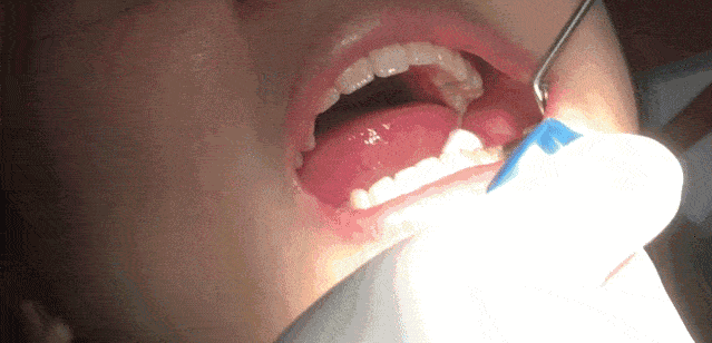 什么时候才不长蛀牙 65841d0cb43a4080ac4bceb950ccee61.gif