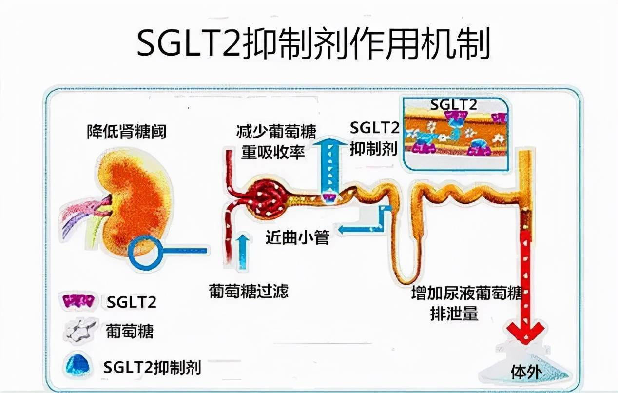 尿中排糖心腎雙重獲益sglt2抑制劑知多少