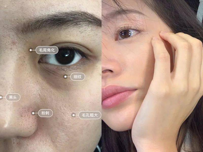 颈椎|头晕恶心手麻原来是颈椎出了毛病！睡它，30分钟缓解酸痛，1个月连血压都降了