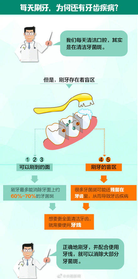 全国|牙线会撑大牙缝吗