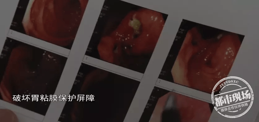 加班|女子晚餐连吃3天月饼，半夜突然吐血！医生紧急提醒