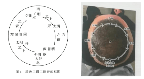 舒肝和胃,缓急止痛,镇静安神,服药配合五运六气针法治疗,小斌终于摆脱