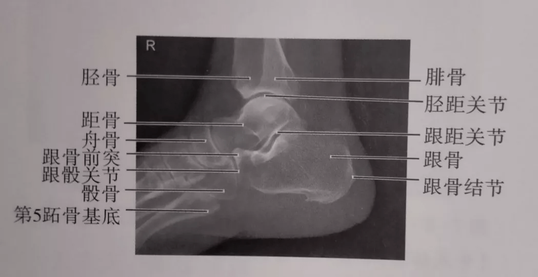 足部解剖x线图片