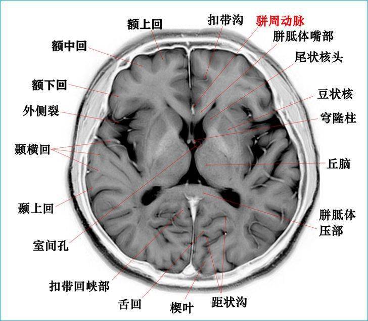 脑子解剖图图片