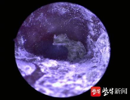 皮肤|耳朵瘙痒当心里面发霉