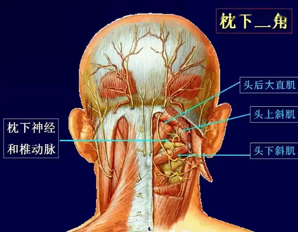 很常见的头痛却迟迟找不到源头