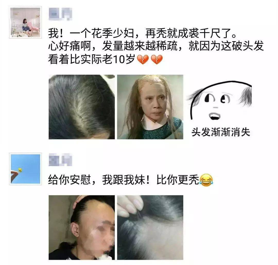 发型为了拯救发际线，日本人可是绞尽脑汁！