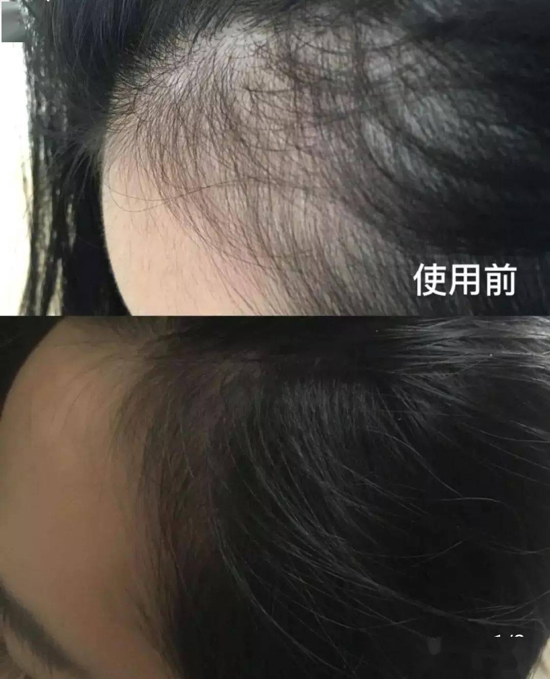 发型为了拯救发际线，日本人可是绞尽脑汁！