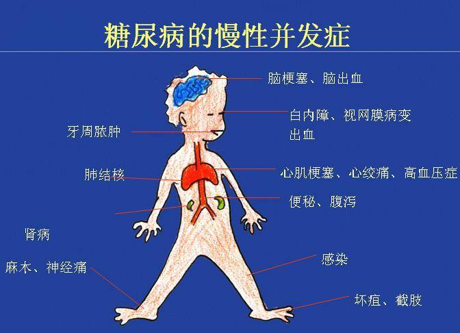 干细胞疗法有效提升糖尿病患者生活质量,让"慢病"或能根治!