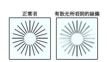 散光究竟对我们的眼睛有没有危害呢?