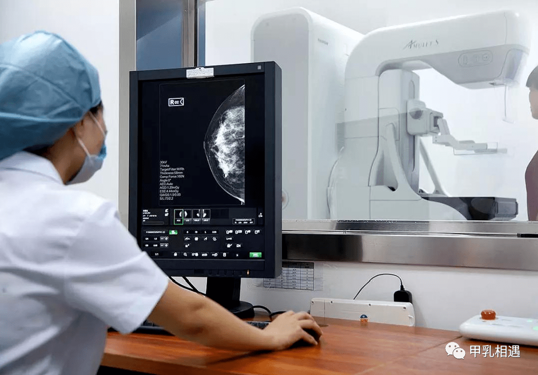 中老年女性建议12年进行一次乳腺钼靶检查