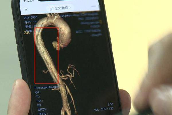 麻将|致死率近100%！阿姨搓了5个钟麻将，突然胸痛