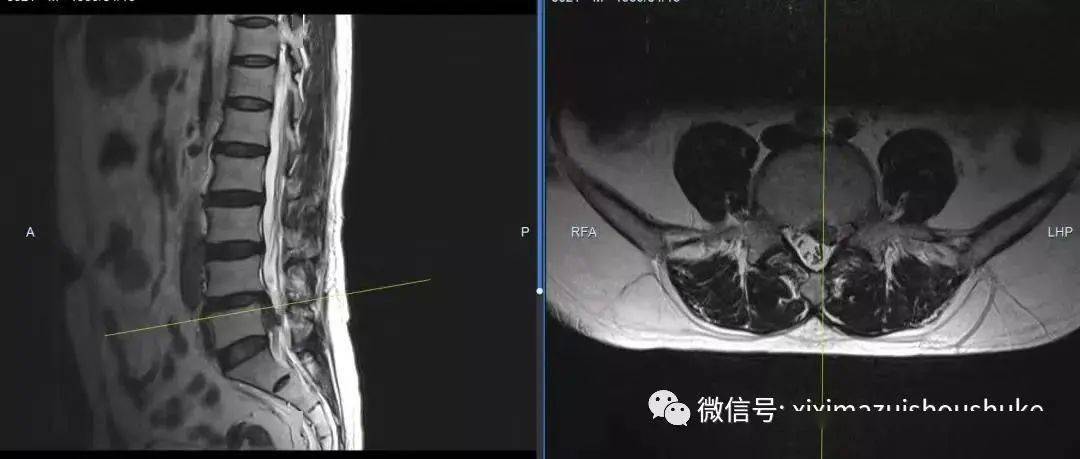 最近是不是又复阳了感觉骨头痛 9d58d75ec3d04358b0725858630c3498.jpeg