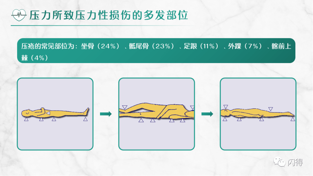 【ppt】压力性损伤预防与护理