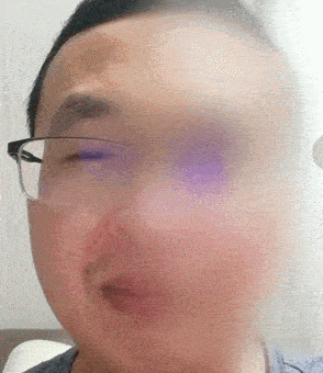 听神经|男子眼皮底下一直跳，到医院一查：结果惊出冷汗