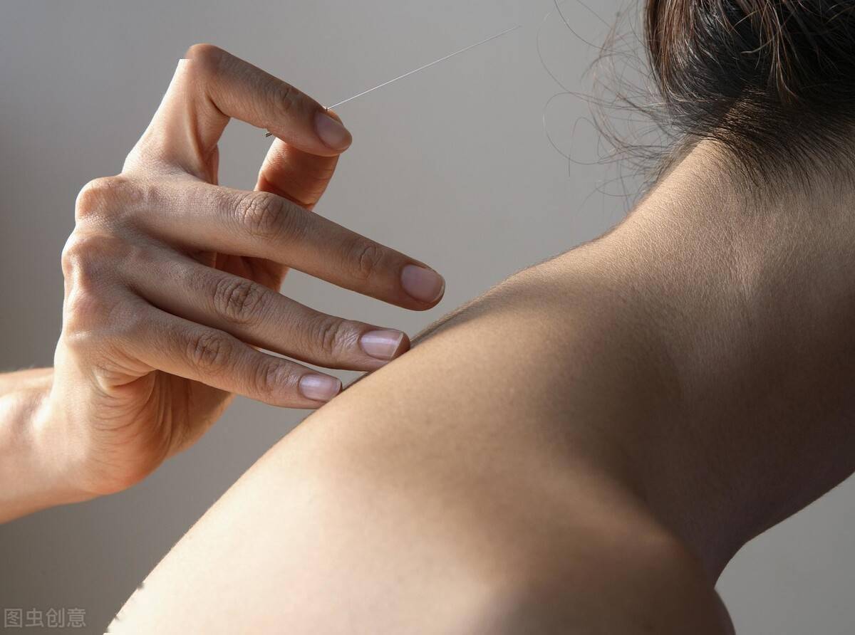 针灸不传之秘止痛要法进气之诀