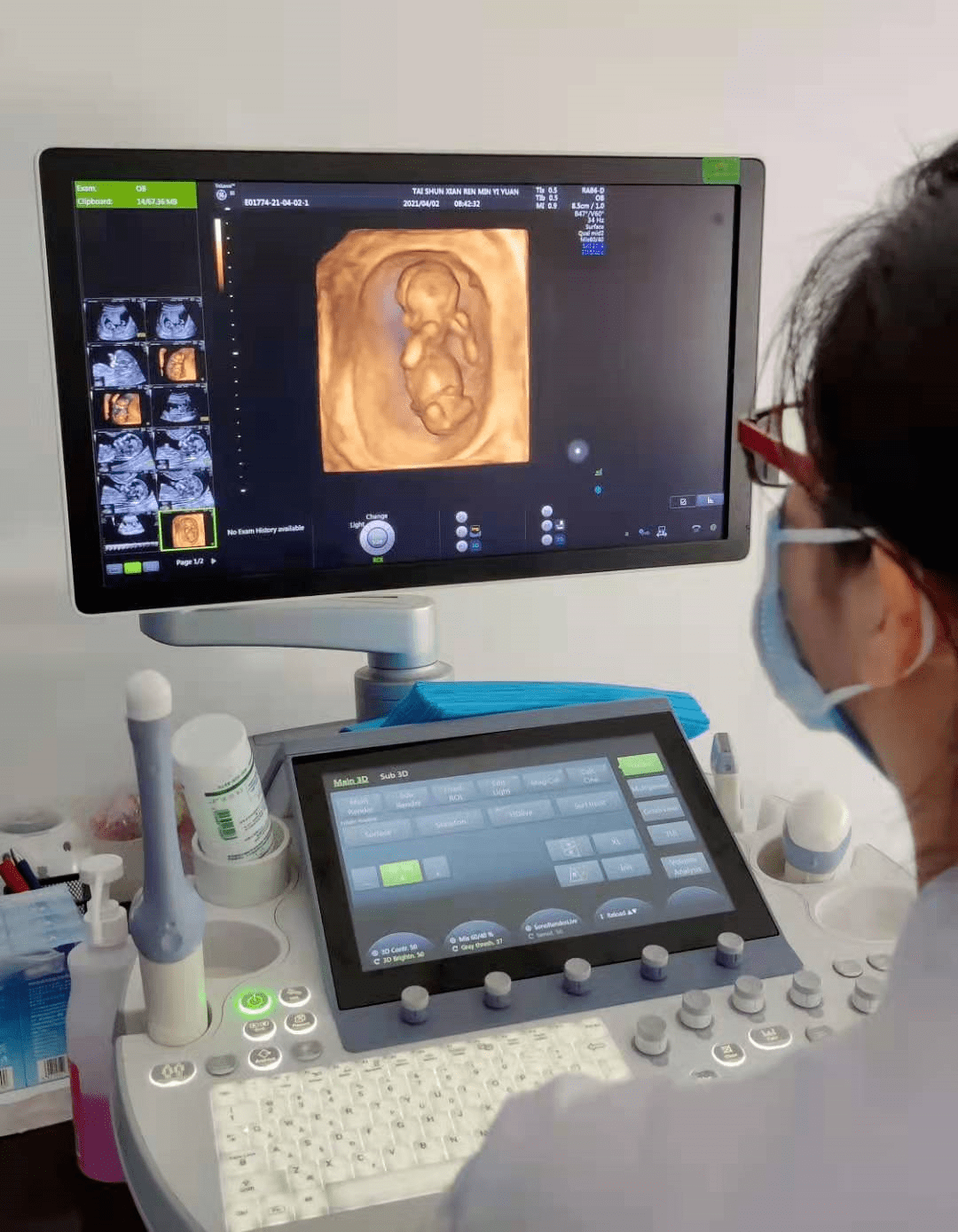 产科三维和胎儿系统筛查产科三维和胎儿系统筛查胎儿系统超声筛查