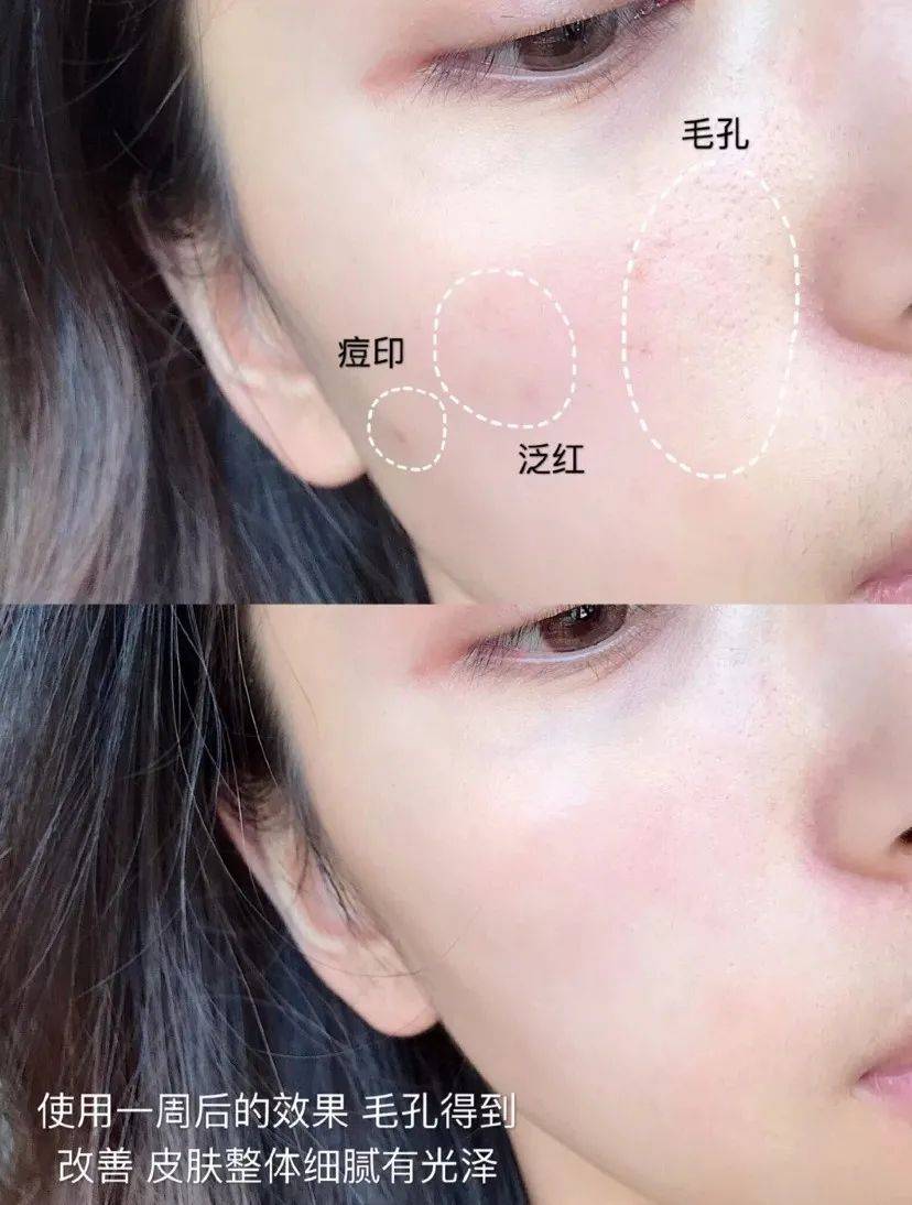 兰蔻手慢无！3.7折抢王牌抗衰精华兰蔻小黑瓶，维稳修护一瓶搞定