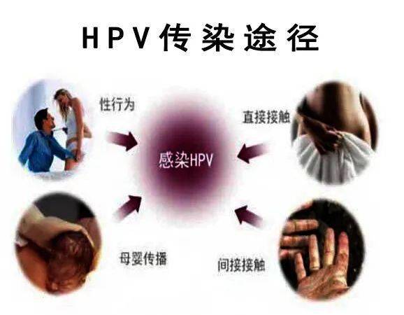 男性hpv感染怎么检查图片