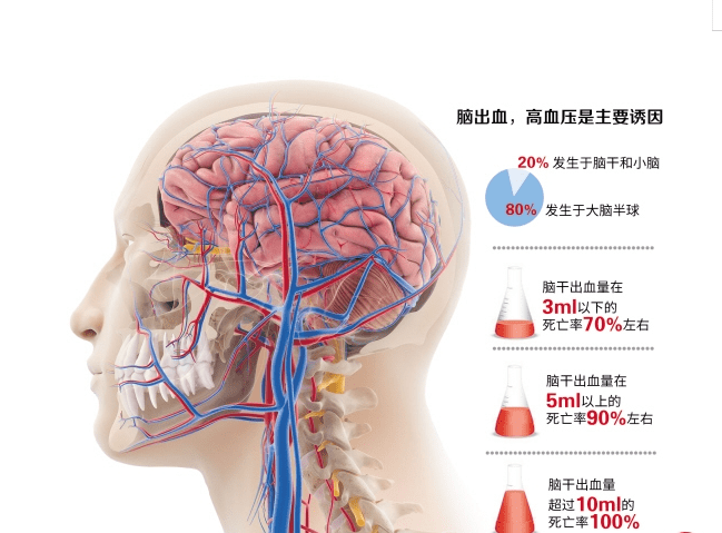 控制|什么是“肠系膜静脉血栓”？