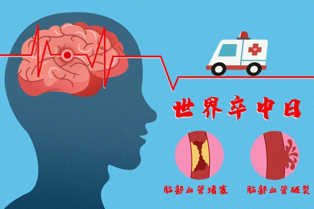 治疗|【世界卒中日】警惕卒中症状，尽早识别救治