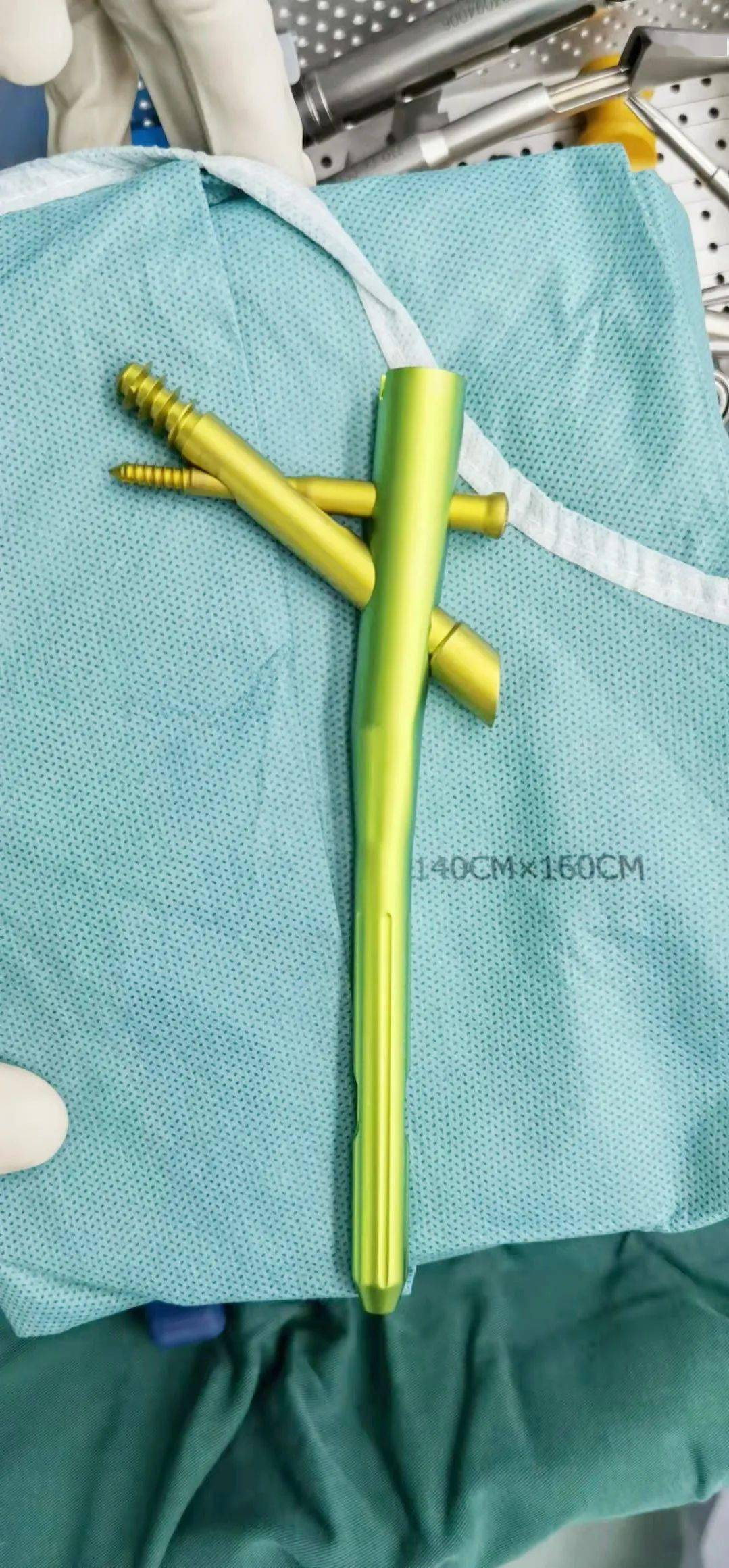 此次股骨近端仿生髓内针系统手术的成功开展,填补了我市该项技术的