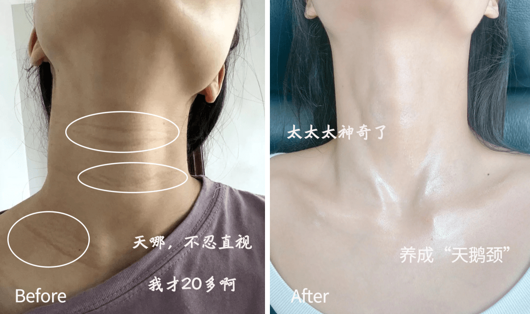 颈部暴露年龄的不仅仅是脸,这个部位同样需要好好保养!