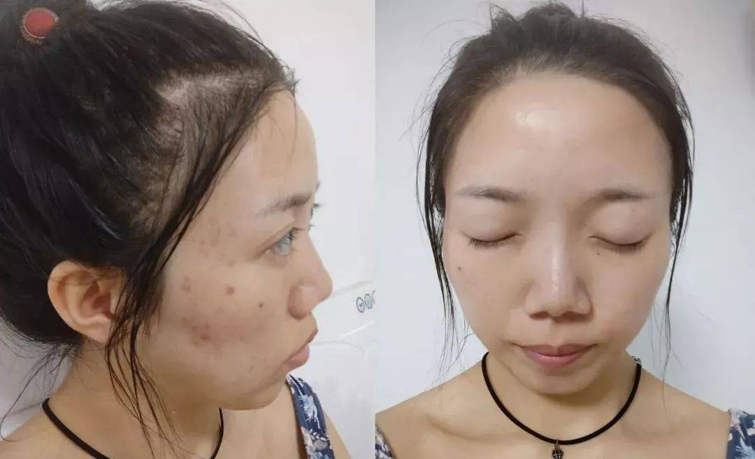 经络60岁的年龄，20岁的脸：女人想越活越年轻，一定要懂得这个秘诀
