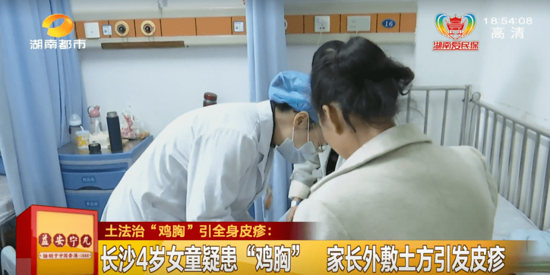 家长|4岁女童疑患“鸡胸”，家长竟用土方法治疗