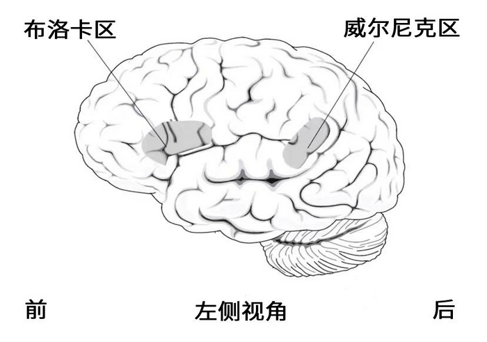 威尔尼克中枢图片